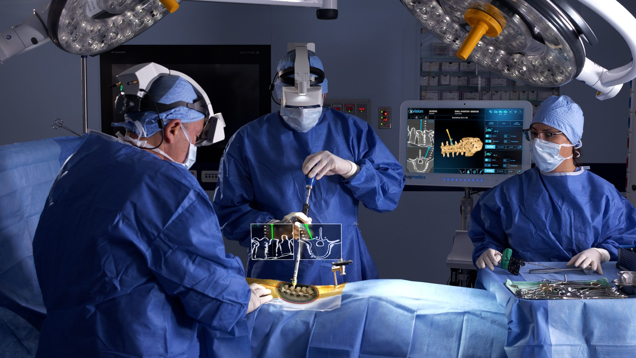 Wallpaper #HmeNC5MBSpphPi3-KNo9163 Augmented Reality Spine Surgery Comprehensive Spine Center