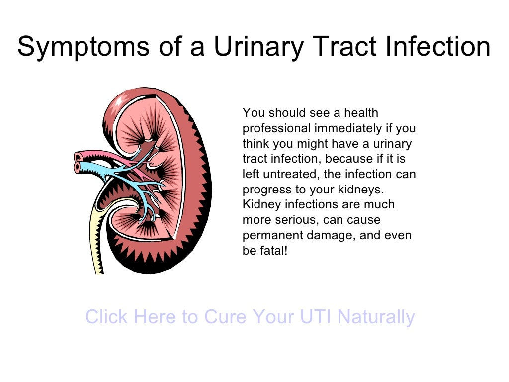 Wallpaper #2D780 182 Bacterial Infections of the Urinary System Biology Libretexts