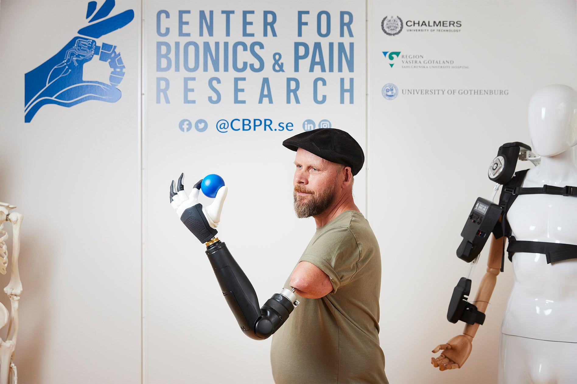 Wallpaper #AfDcf5cBi4JM6agGcSER125 Above Elbow Bionic Arm Can Control Every Finger Scientific American