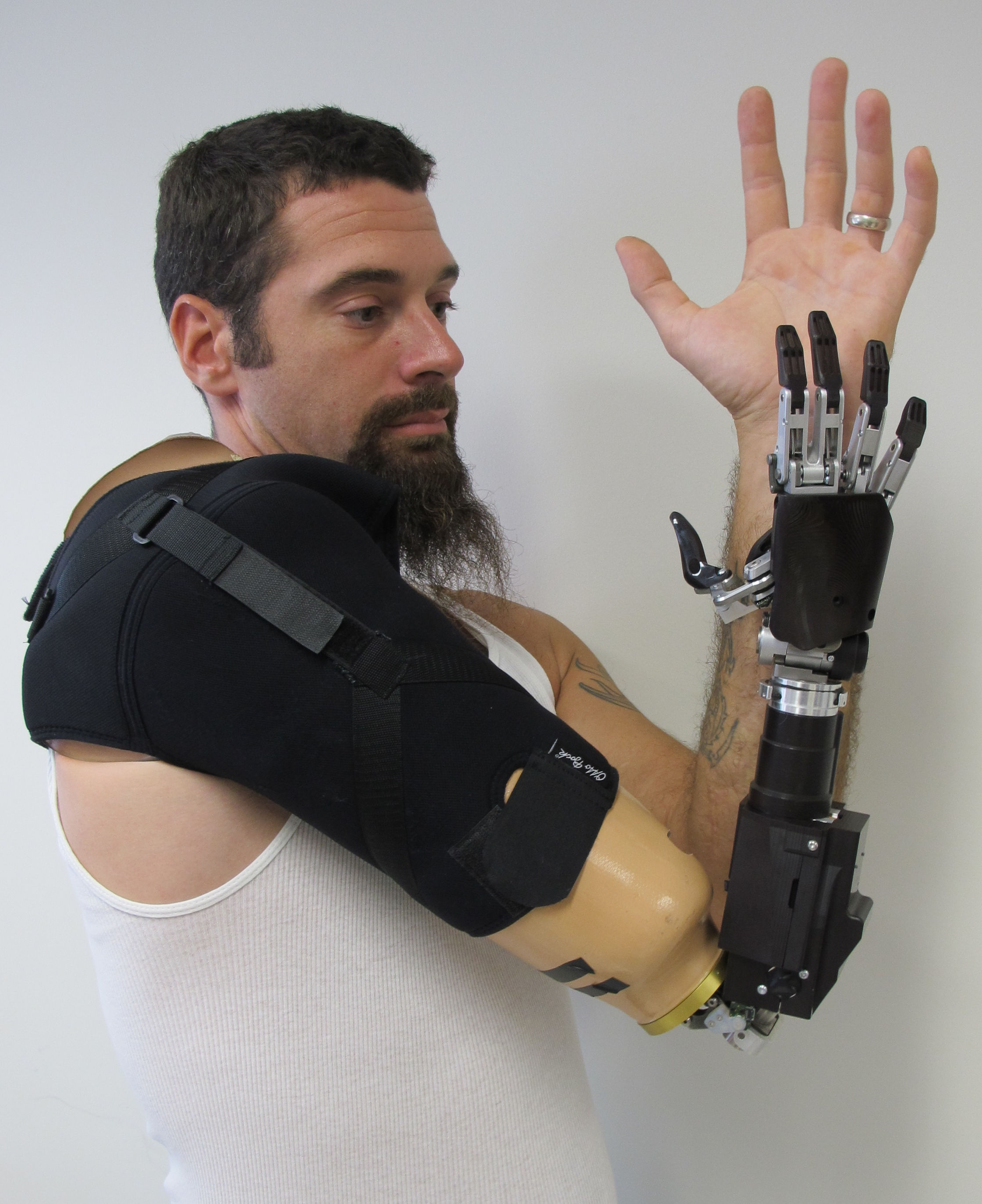 Wallpaper #yCymSZMB0E1QgA7wRfMq163 Types of Prosthetic Arms