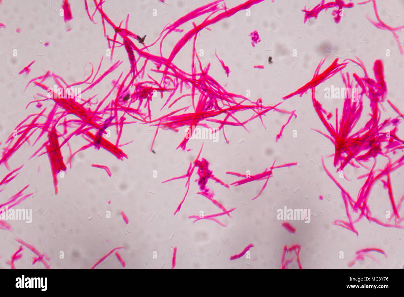 Wallpaper #WWdkEpMBSpphPi3-tvsO342 Smooth Muscle Separate Under the Microscope Abstract Pink Lines on