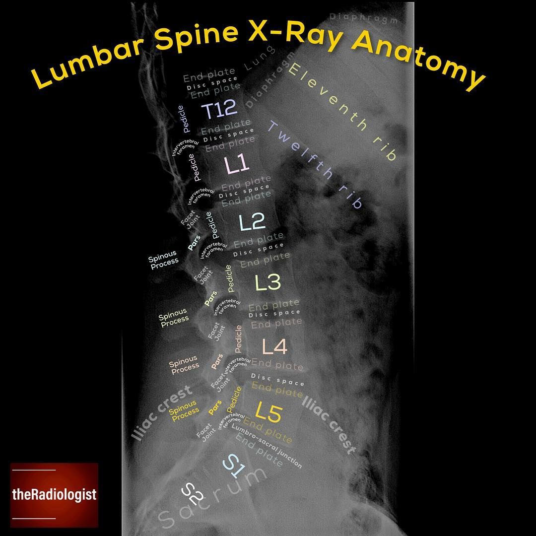Wallpaper #HmeNC5MBSpphPi3-KNo9265 Read on for a System to Assess the Lumbar Spine Lateral X Ray L