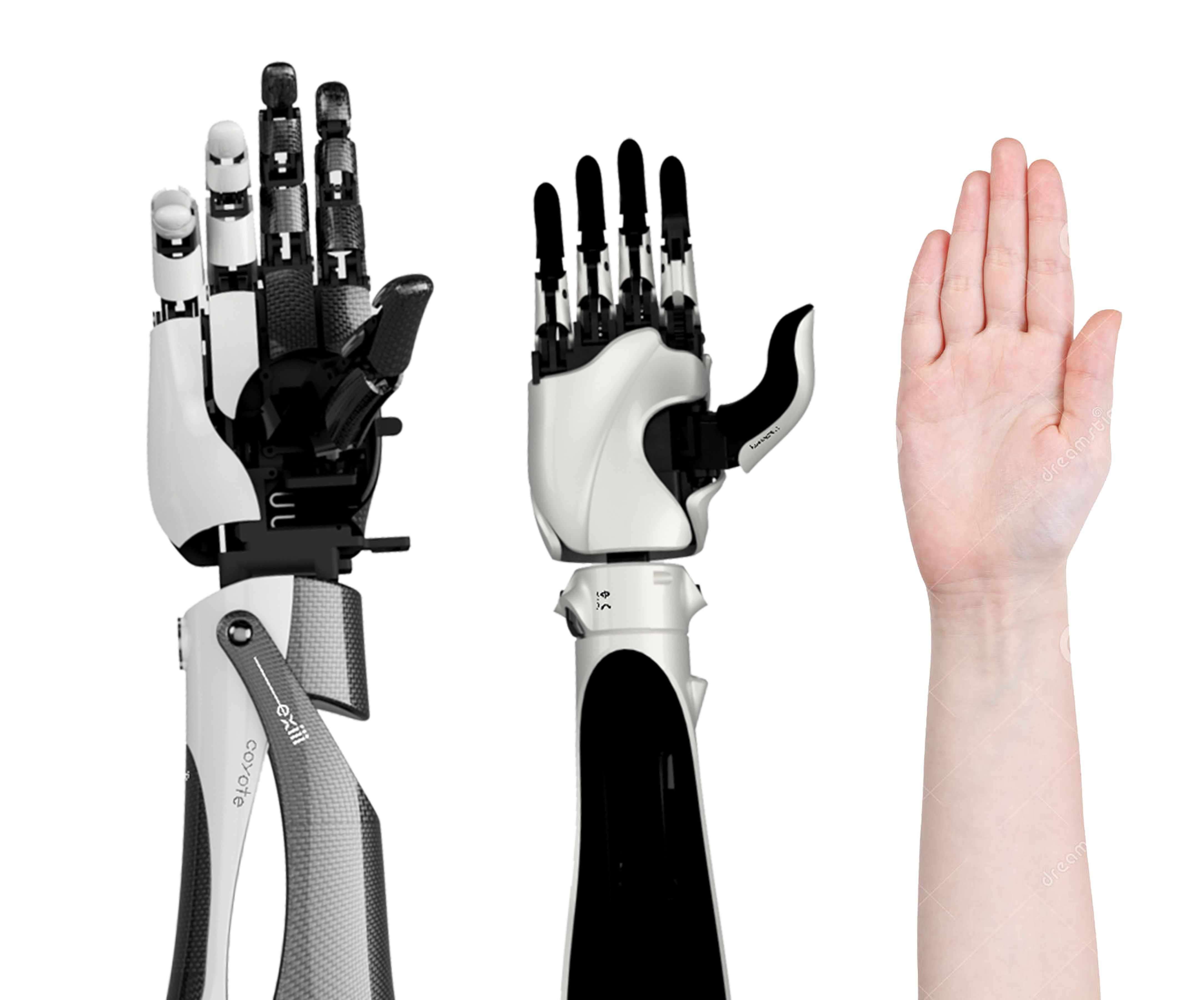 Wallpaper #AfDcf5cBi4JM6agGcSER40 The Hackberry is a 3D Printable Myoelectric Prosthetic Arm Created by