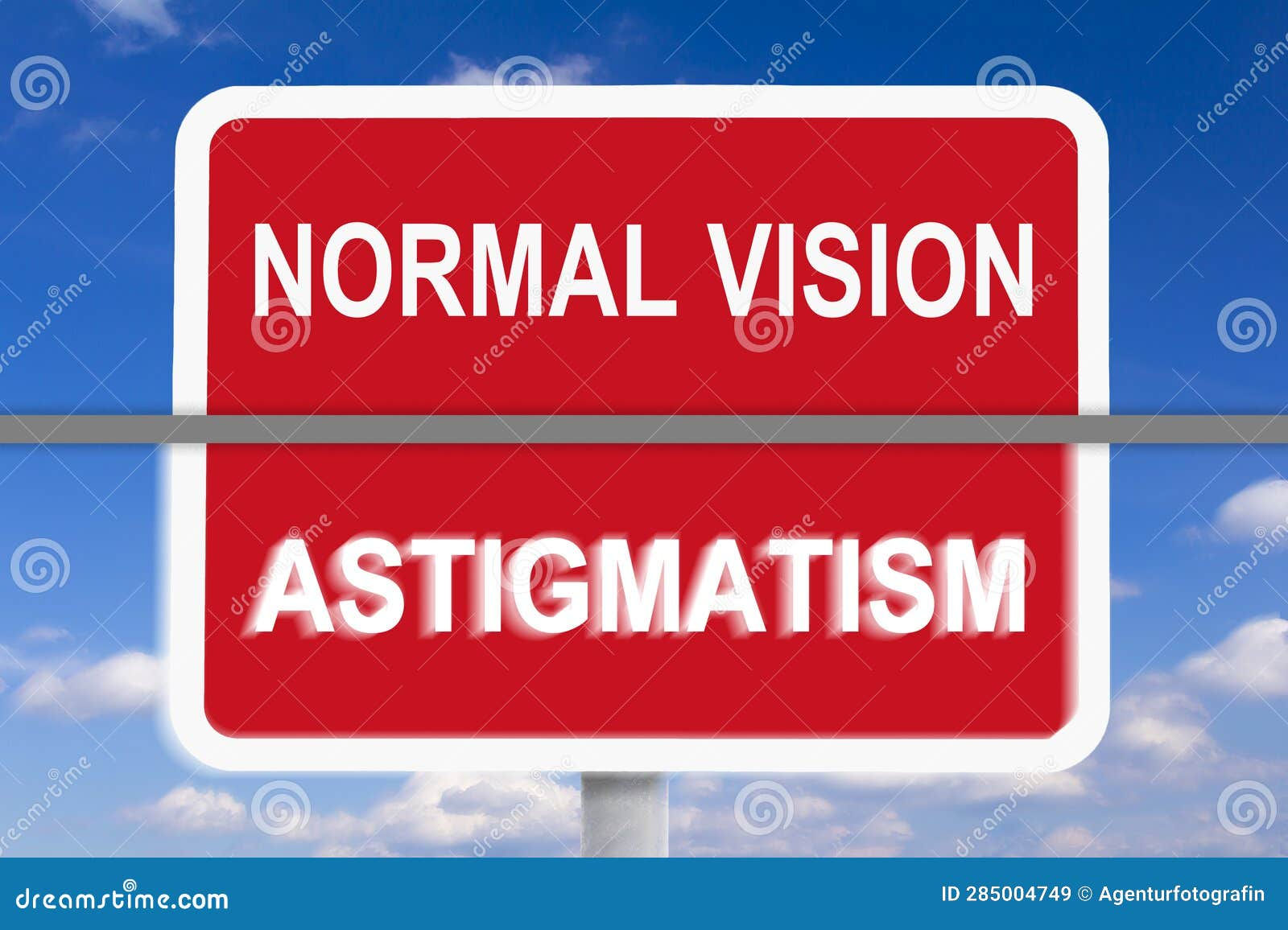 Wallpaper #daVCOJMBVBiSkHCaLY0v162 Example Normal Vision vs Astigmatism Stock Image Image of Normal