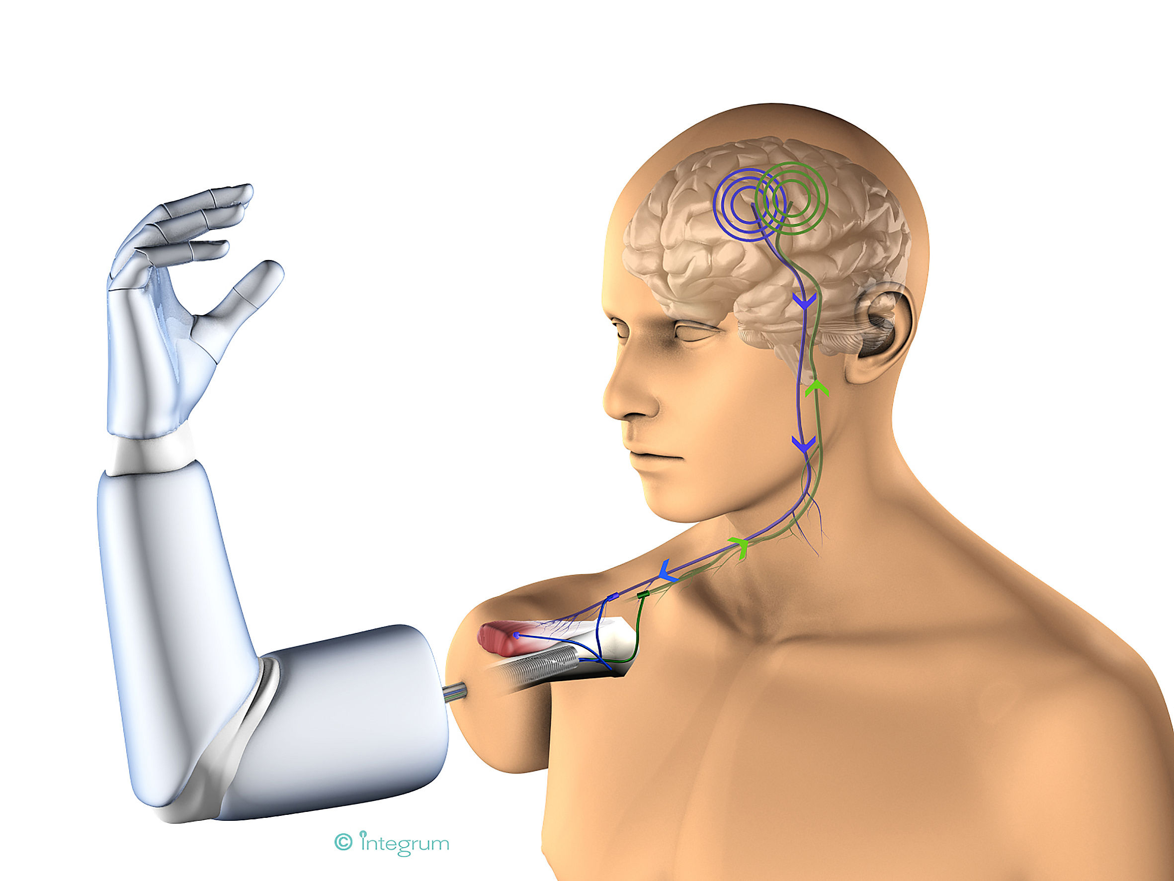 Wallpaper #AfDcf5cBi4JM6agGcSER48 World First Robotic Arm Directly Connects to Bone Muscles and Nerves