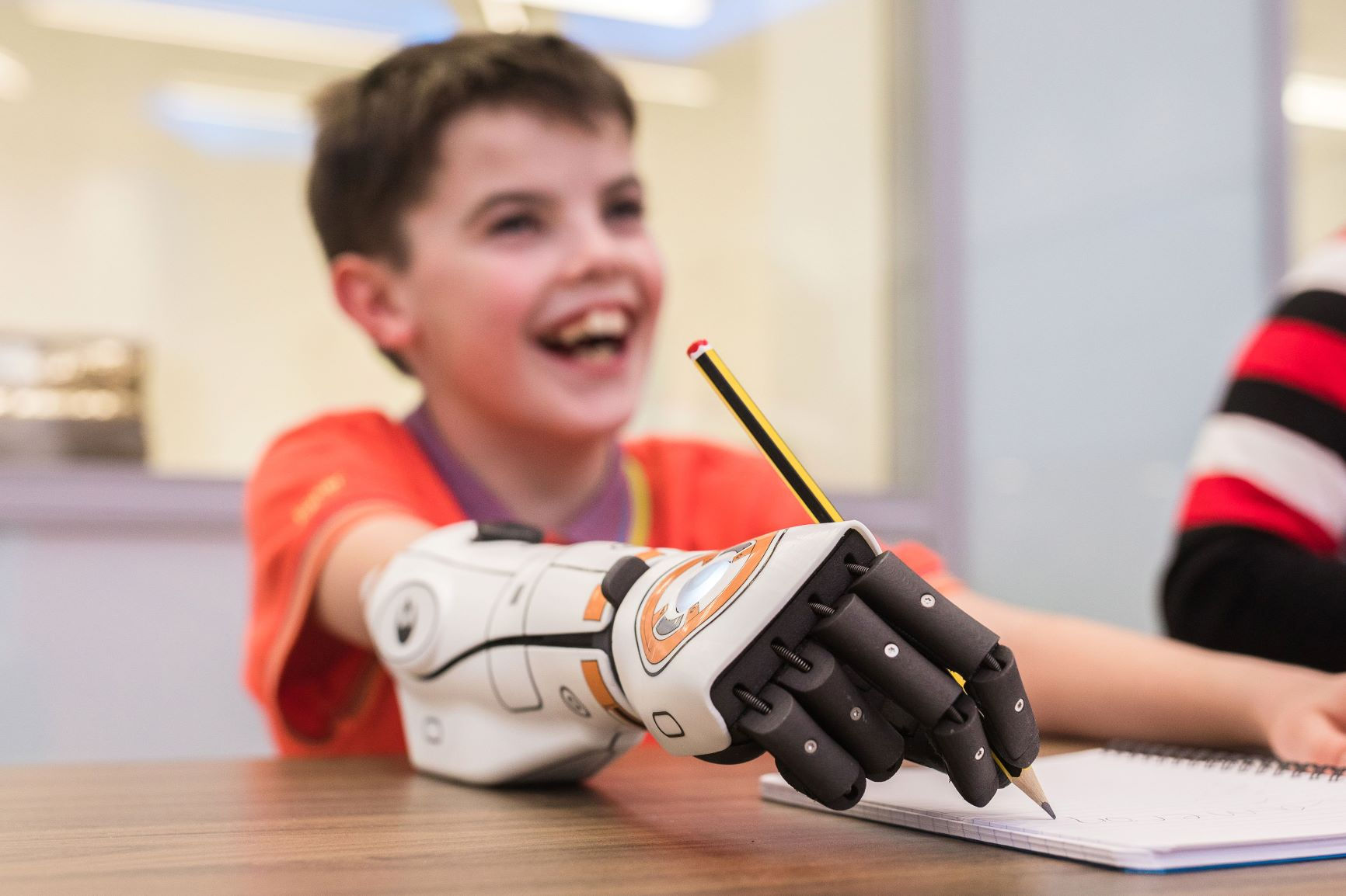 Wallpaper #AfDcf5cBi4JM6agGcSER4 How Do Prosthetic Arms Work Open Bionics
