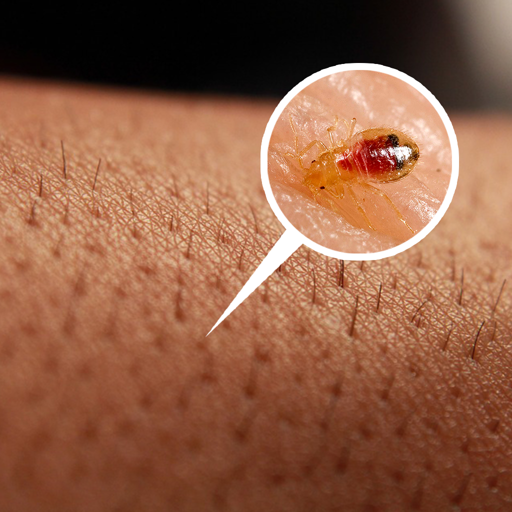 Wallpaper #9mdFCpMBSpphPi3-NNO0316 Can You Feel Bed Bugs Crawling on Your Skin Bed Bug Sos