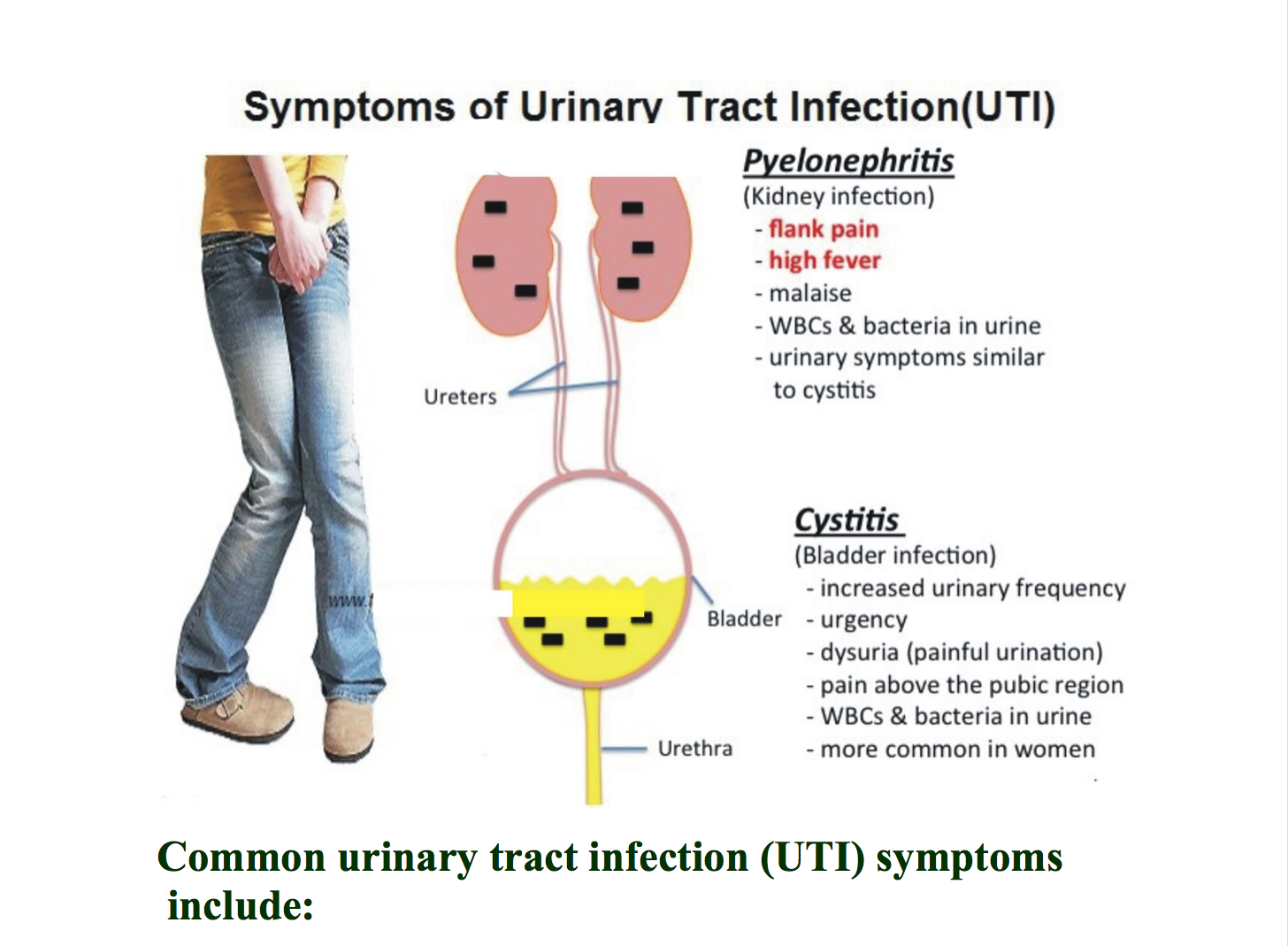 Wallpaper #2D780 182 Bacterial Infections of the Urinary System Biology Libretexts