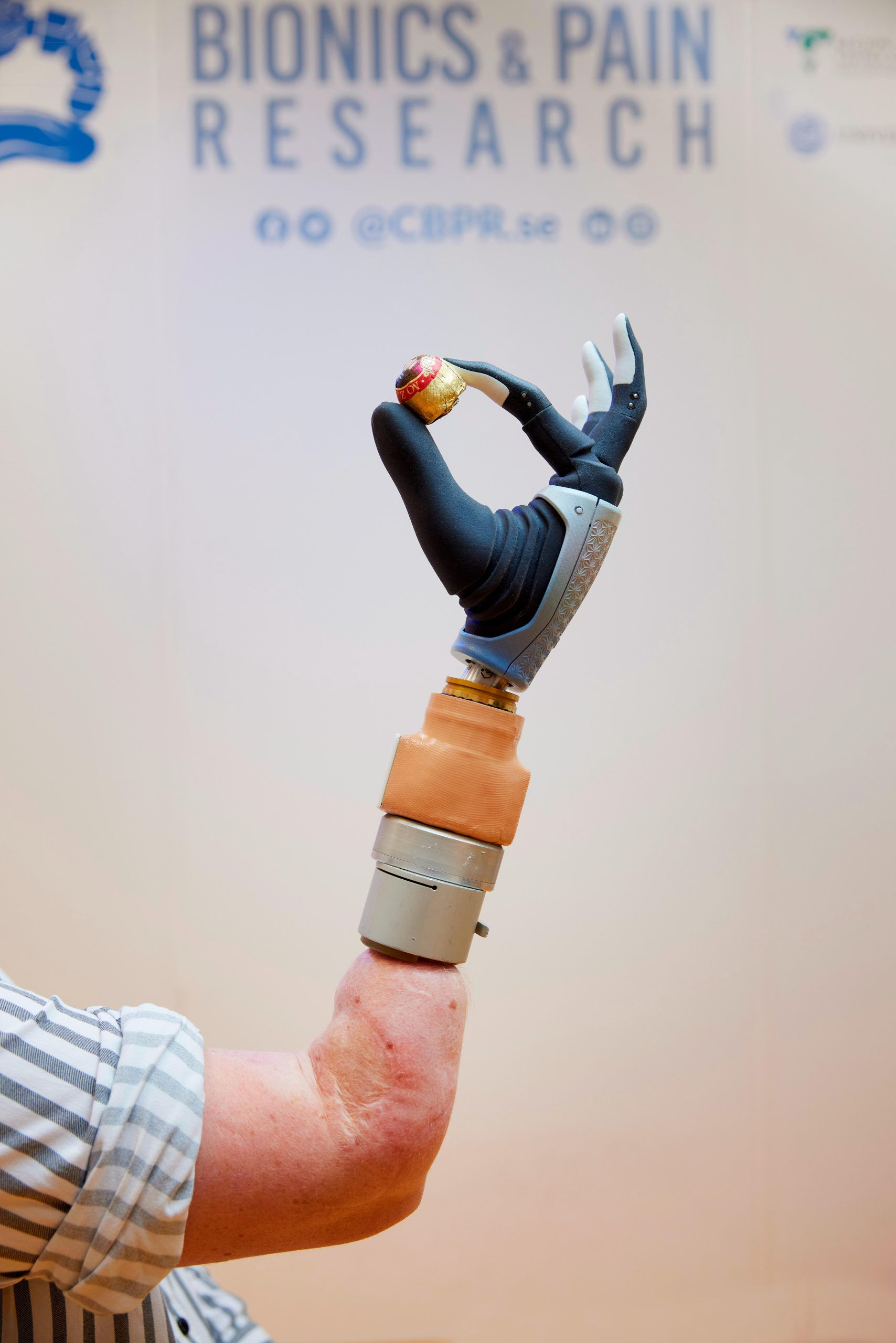 Wallpaper #AfDcf5cBi4JM6agGcSER20 Revolutionizing Prosthetics Scientists Develop Bionic Hand That