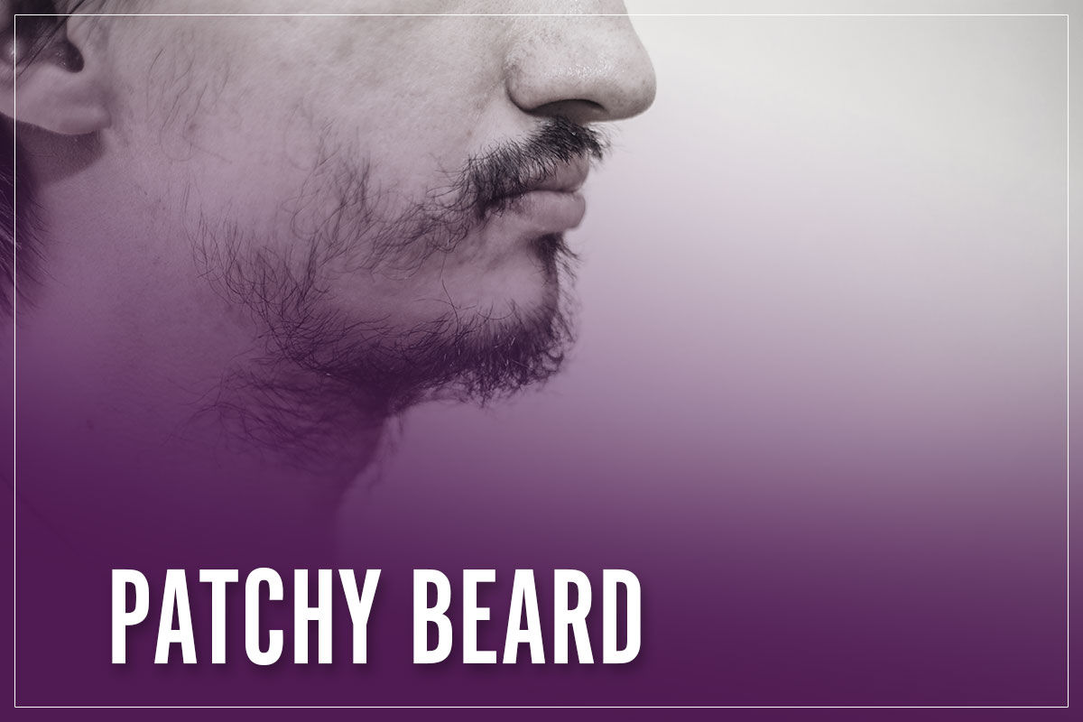 Wallpaper #1zEZNpMB5zzyi_yY1Vho219 Patchy Beard Causes How to Fix Fill in the Patches I Full 2023 Guide