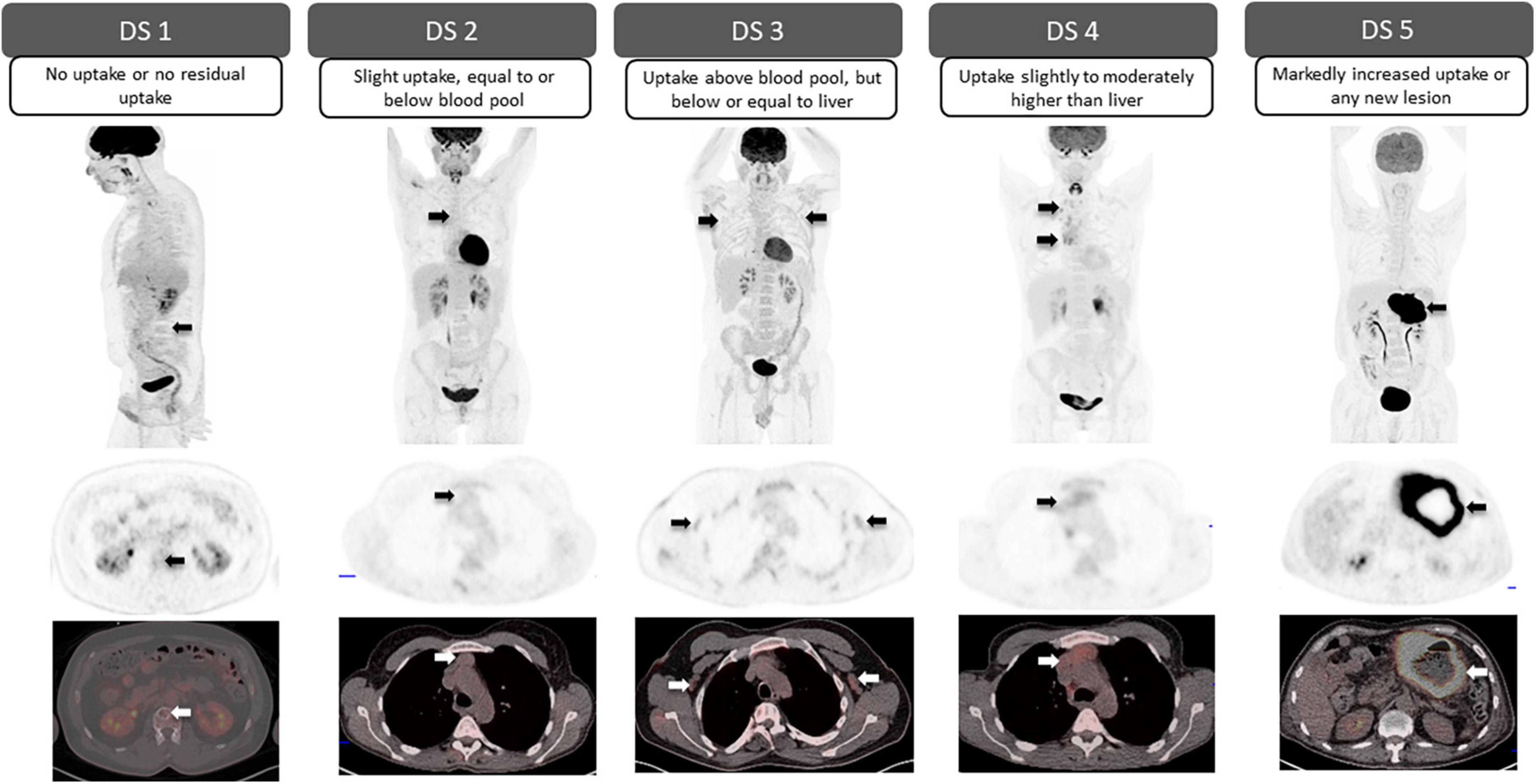Wallpaper #v7hw2pIBJvJKYCmEjfFq150 Frontiers Standardized Classification Schemes in Reporting Oncologic