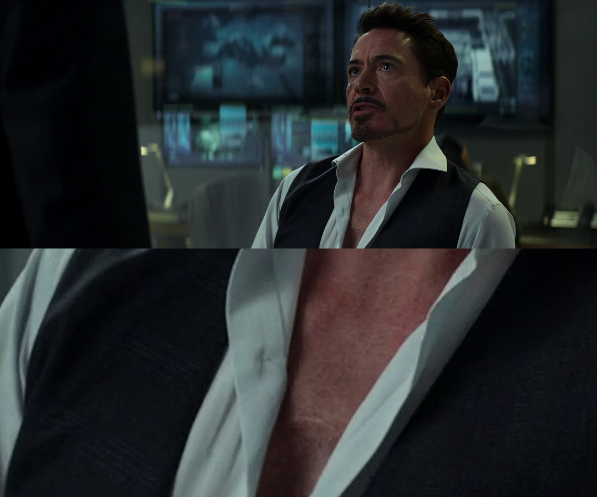 Wallpaper #OaWdOJMBVBiSkHCa5I7X205 I Never Noticed the Scar Tissue on Tonys Chest in Captain America