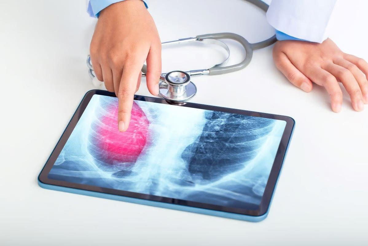 Wallpaper #42duCZMBSpphPi3-8s_3436 Experimental Device Aims to Test Breath for Lung Cancer Upicom