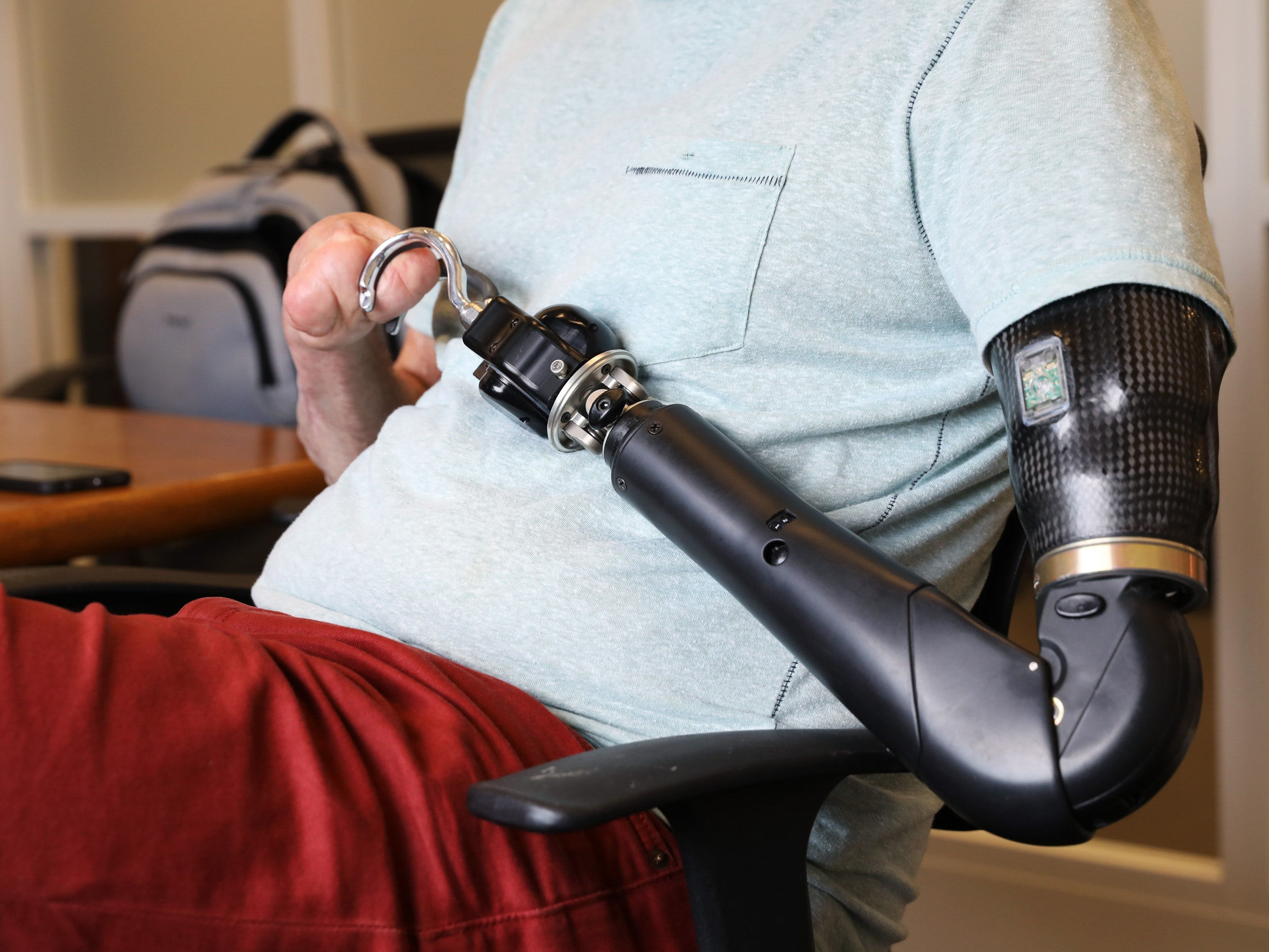 Wallpaper #AfDcf5cBi4JM6agGcSER60 Bionic Arm Prosthetics