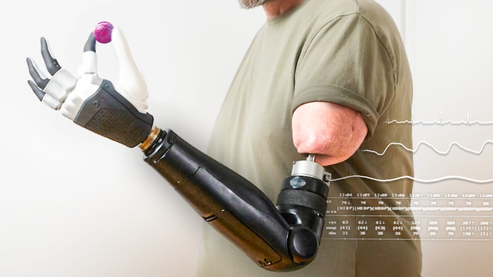 Wallpaper #EBqIT5MB1yWOL4qgrX-V86 Watch How Mind Controlled Bionic Arms Fuse to the Body Currents Wired
