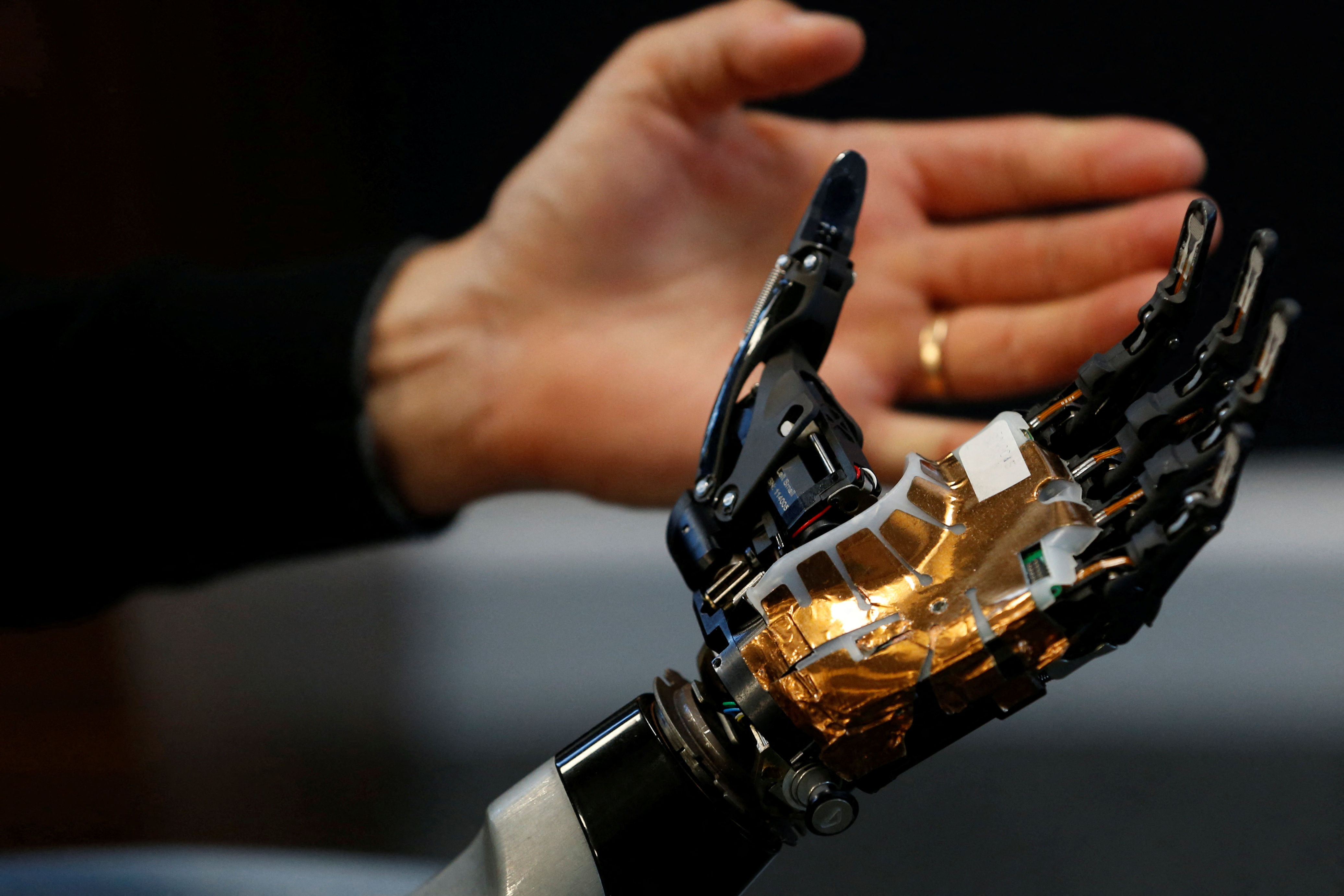 Wallpaper #AfDcf5cBi4JM6agGcSER87 Bionic Hand Can Be Updated with New Gestures Anytime Anywhere Reuters