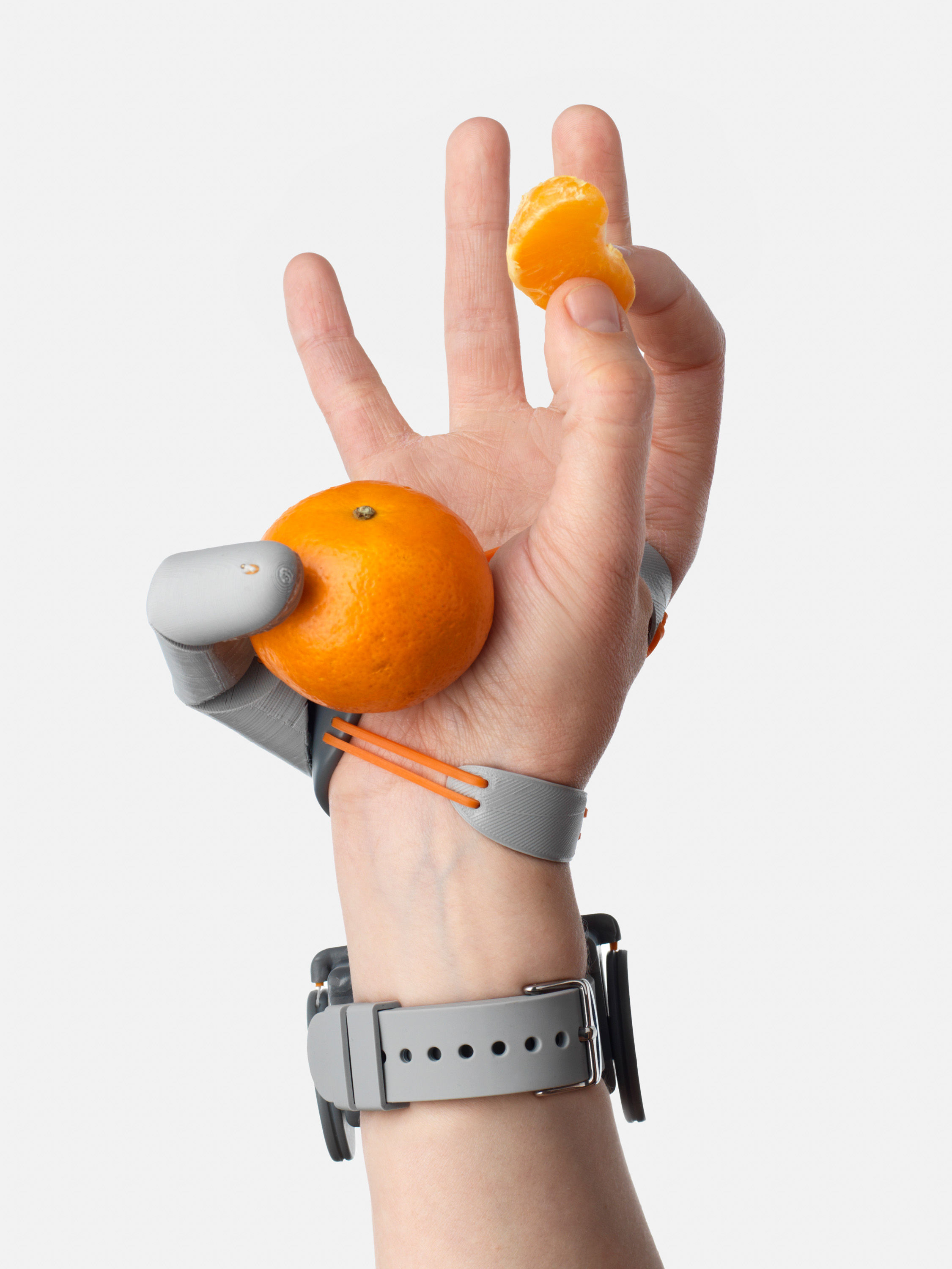 Wallpaper #AfDcf5cBi4JM6agGcSER188 Types of Prosthetic Arms